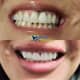 Slider image (9) Kool Dental